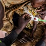 A health worker measures a Sudanese child's arm at a clinic in Renk, in neighbouring South Sudan
